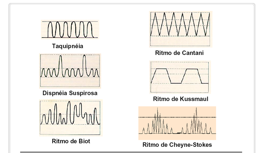 Medir la frecuencia respiratoria